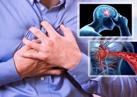سکته قلبی و مغزی از مهم‌ترین تبعات گرفتگی عروق