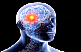 ابداع رویکردی جدید برای درمان یکی از تهاجمی‌ترین انواع سرطان مغز