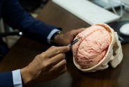 دستیابی ایران به دانش فنی ساخت مغز مصنوعی